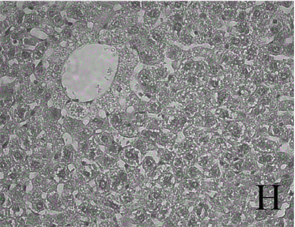 Application of traditional Chinese medicine combination in preparation of drug for treating alcoholic fatty liver