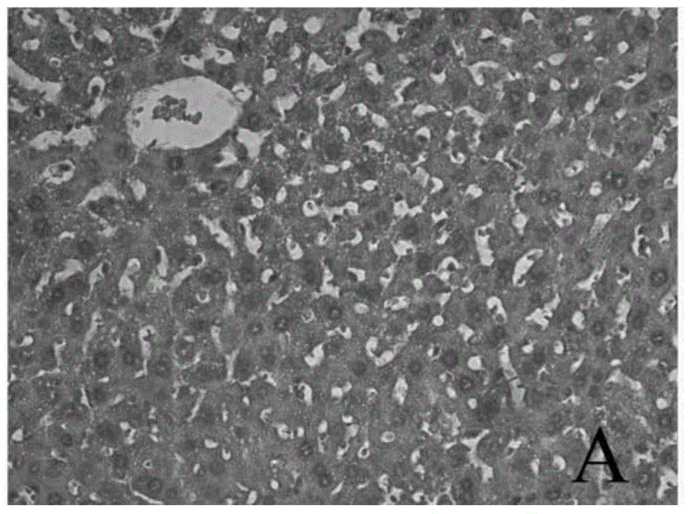 Application of traditional Chinese medicine combination in preparation of drug for treating alcoholic fatty liver