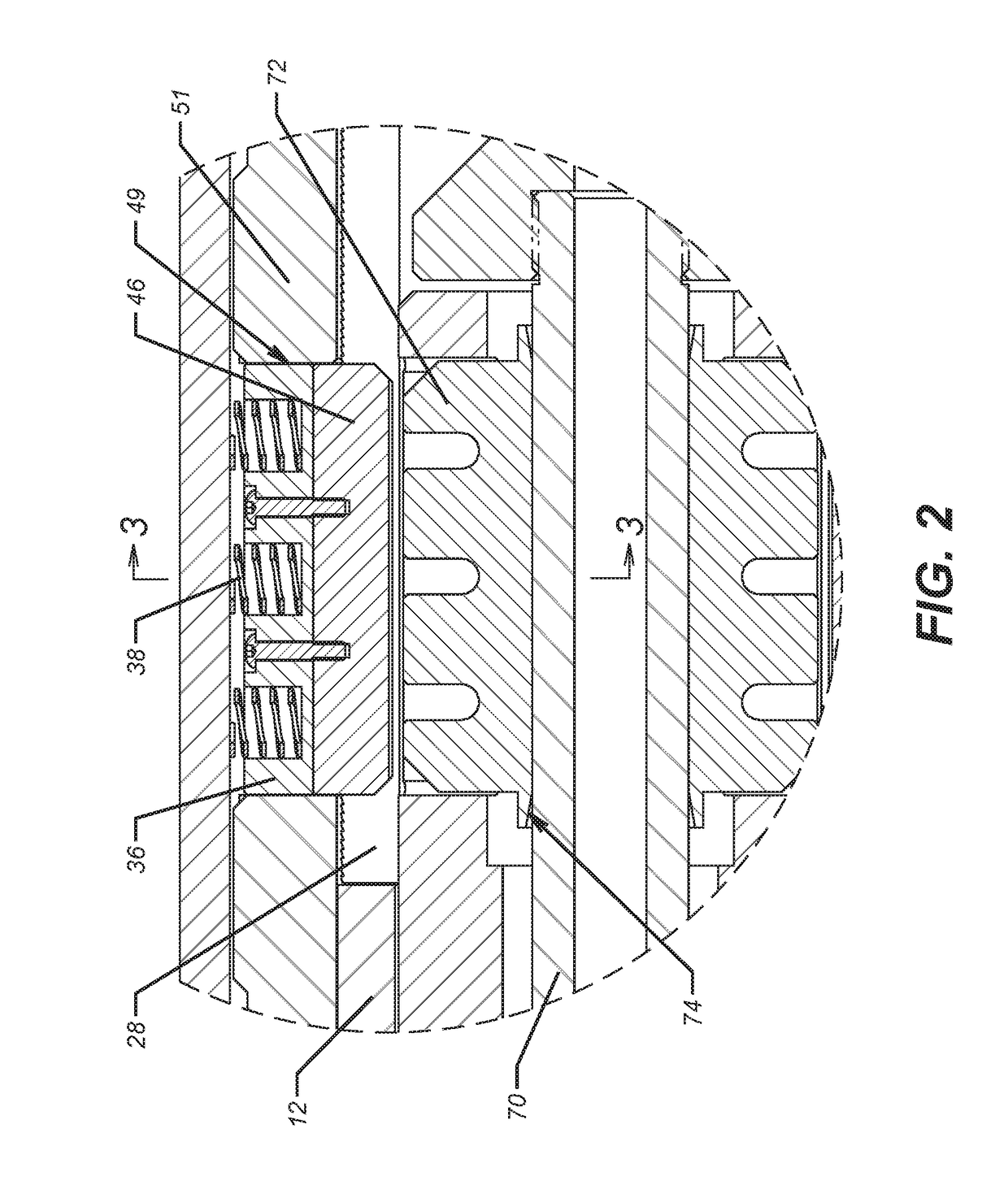 Radially Expandable Ratcheting Body Lock Ring for Production Packer Release