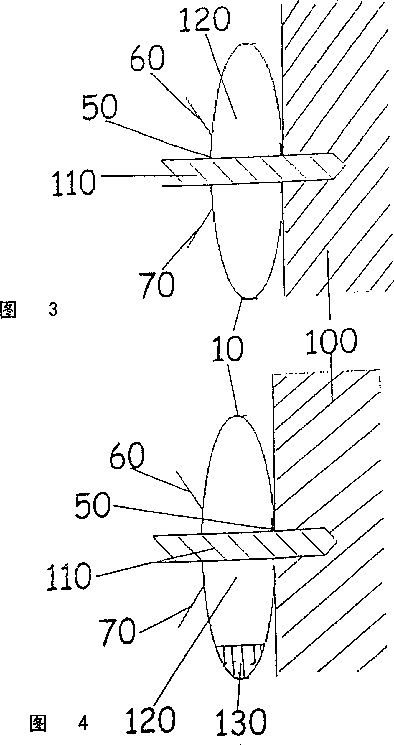 Debris collection device and method