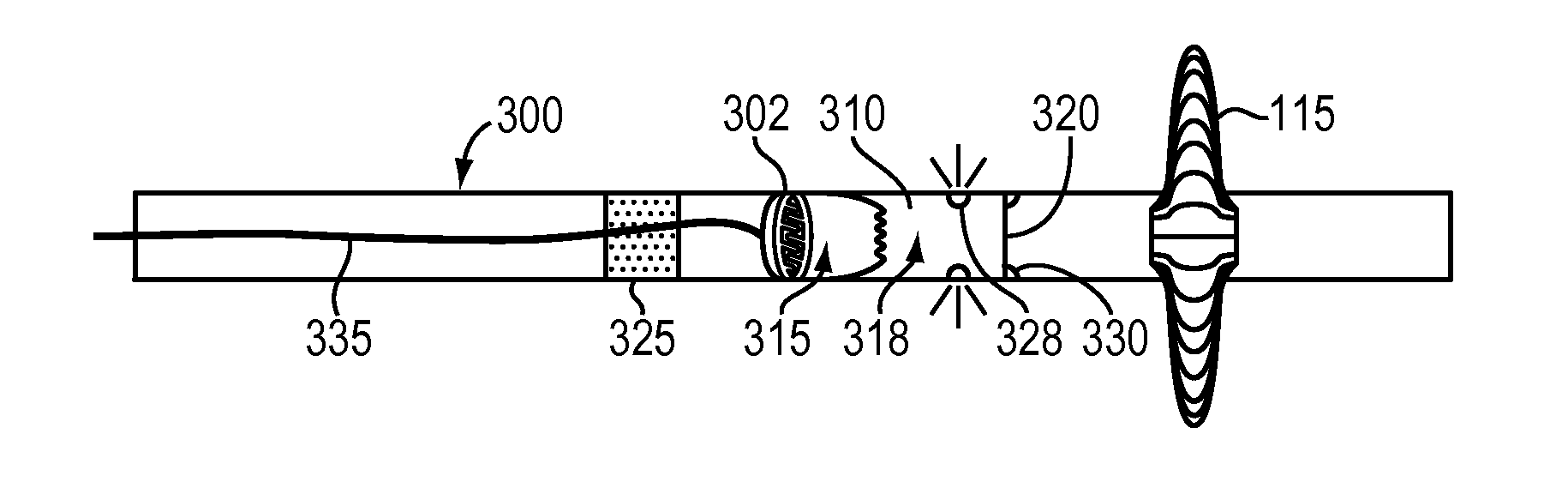 Catheter drug pump