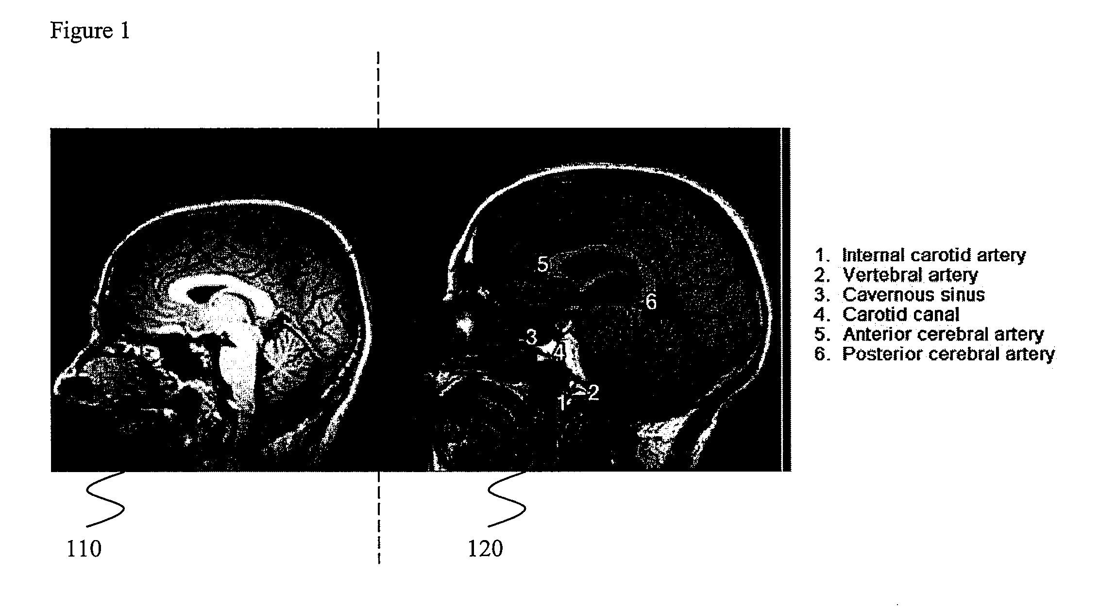 Systems and methods for synchronized image viewing with an image atlas