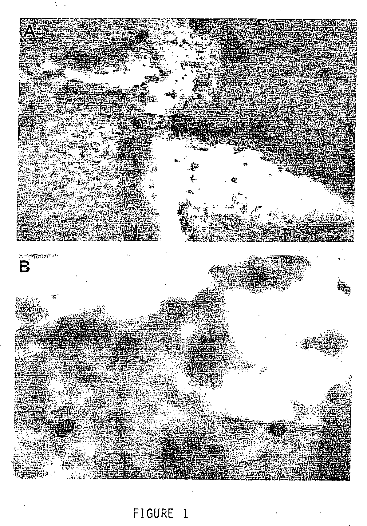 Corneal cells expressing active agents and methods of use thereof