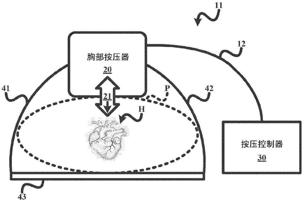 Lightweight electro-mechanical chest compression device