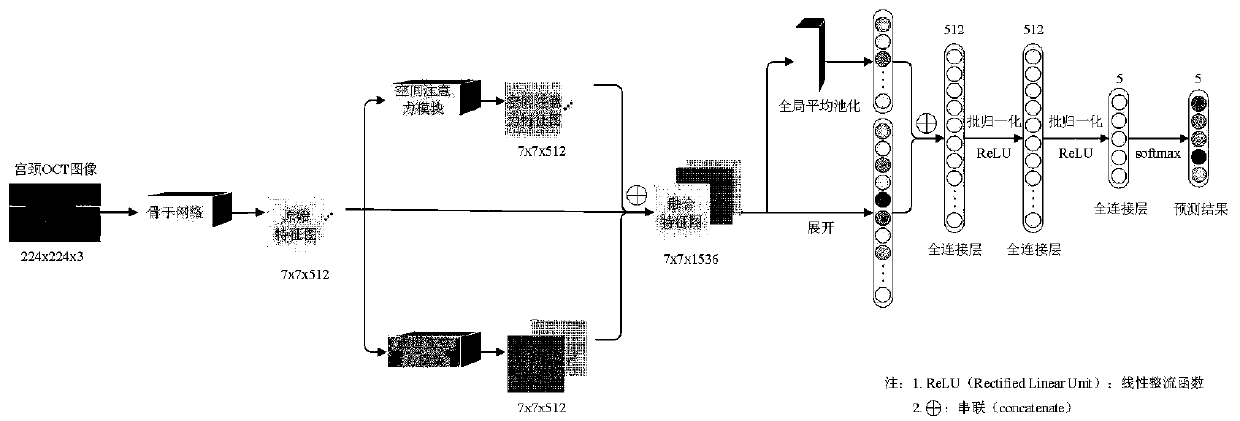 Cervix uteri OCT image classification method and system based on two-way attention convolutional neural network