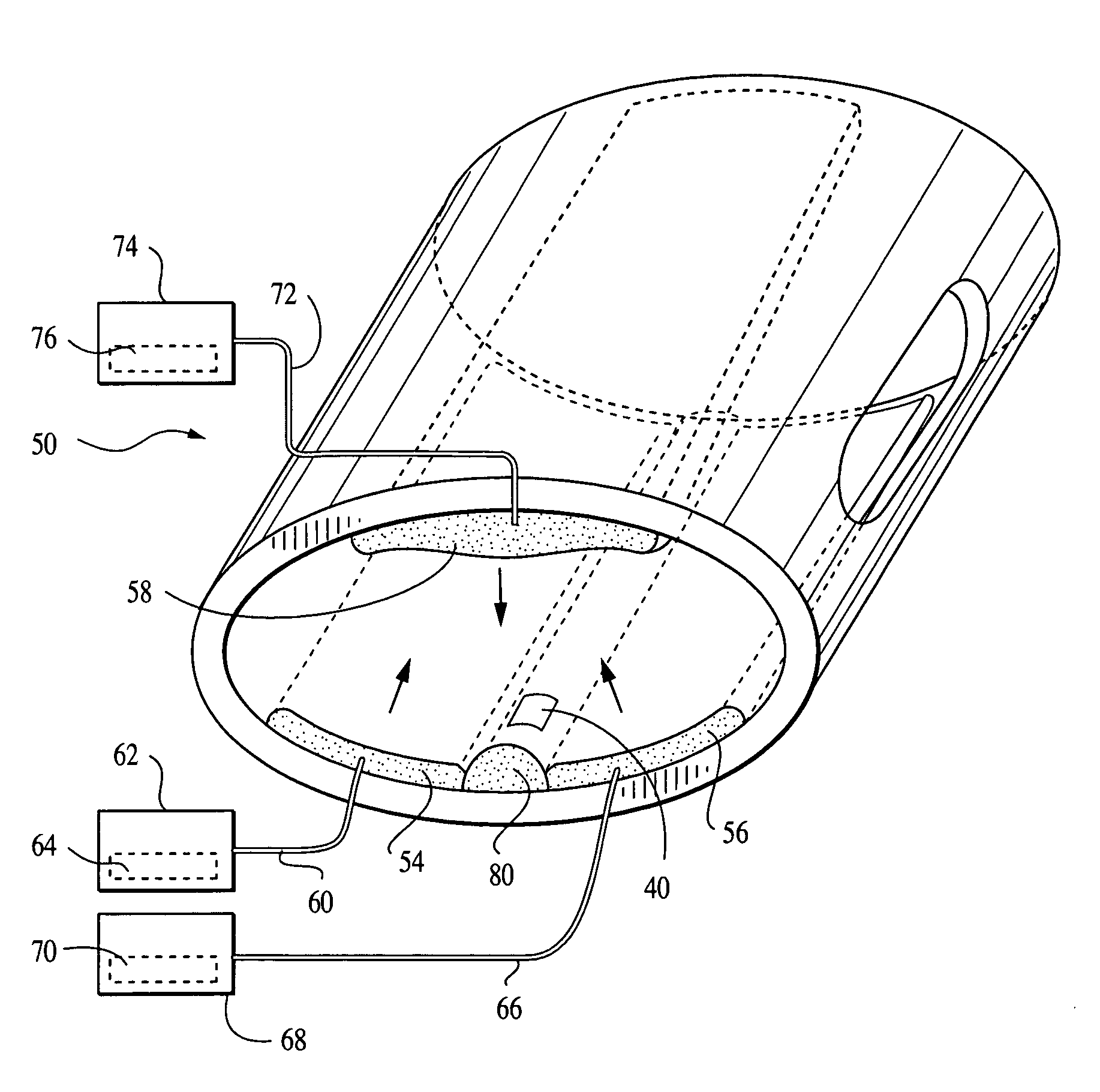 Configurable apparatus and method for treating carpal tunnel syndrome