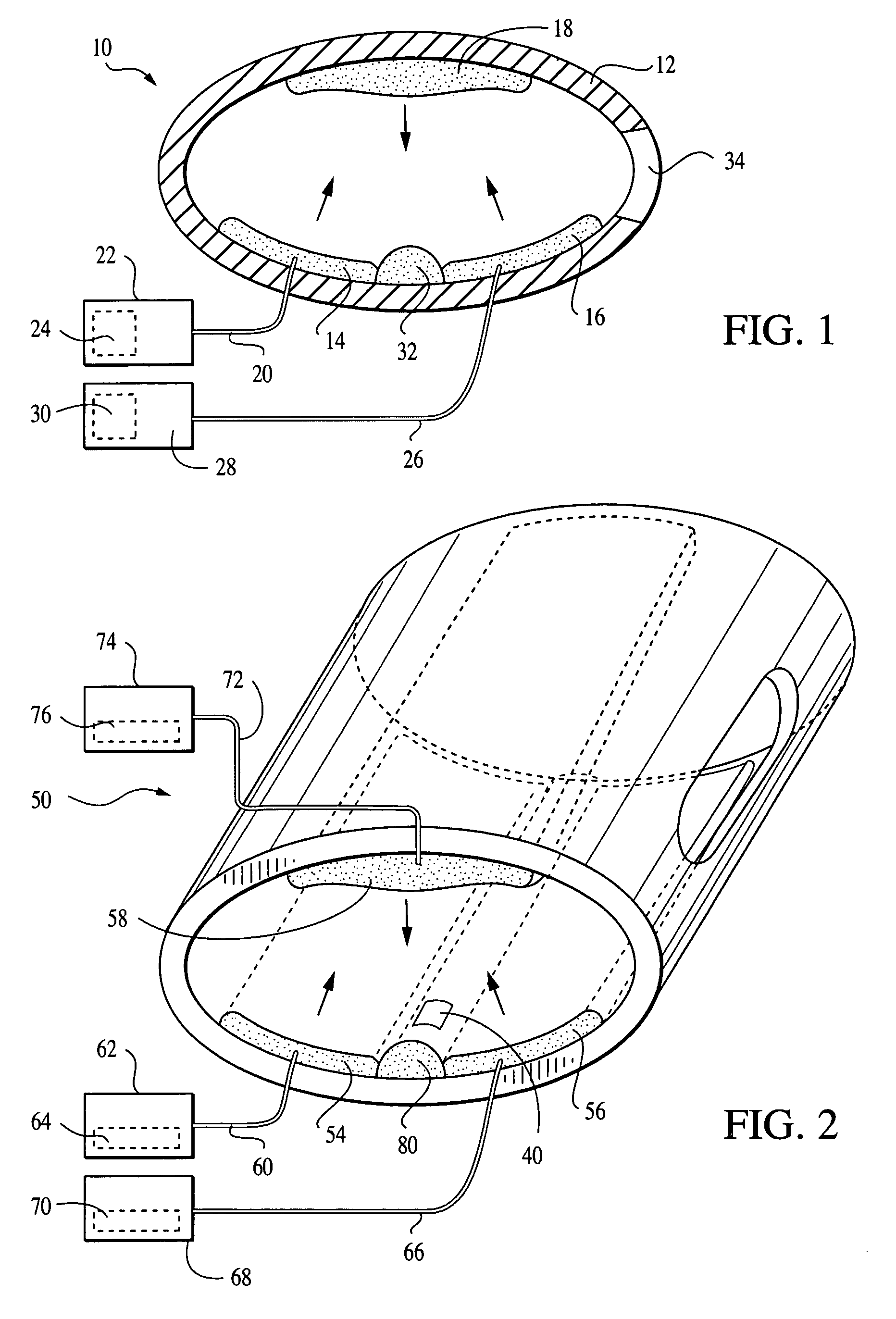 Configurable apparatus and method for treating carpal tunnel syndrome