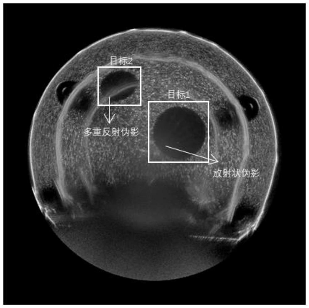 Anti-artifact feature extraction method based on ultrasonic tomography reflection image convex target