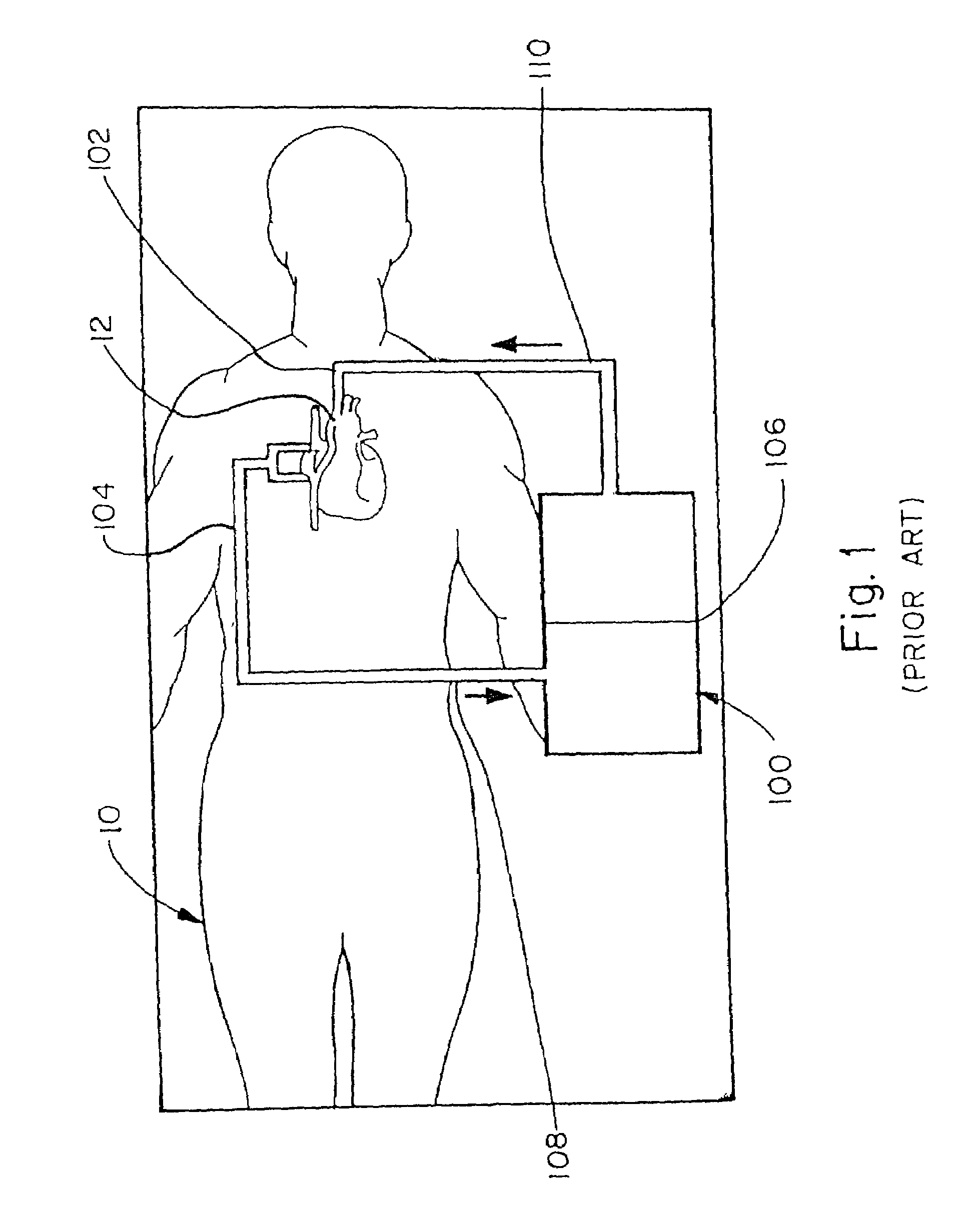 Hemo-concentrator system for autologous blood recovery