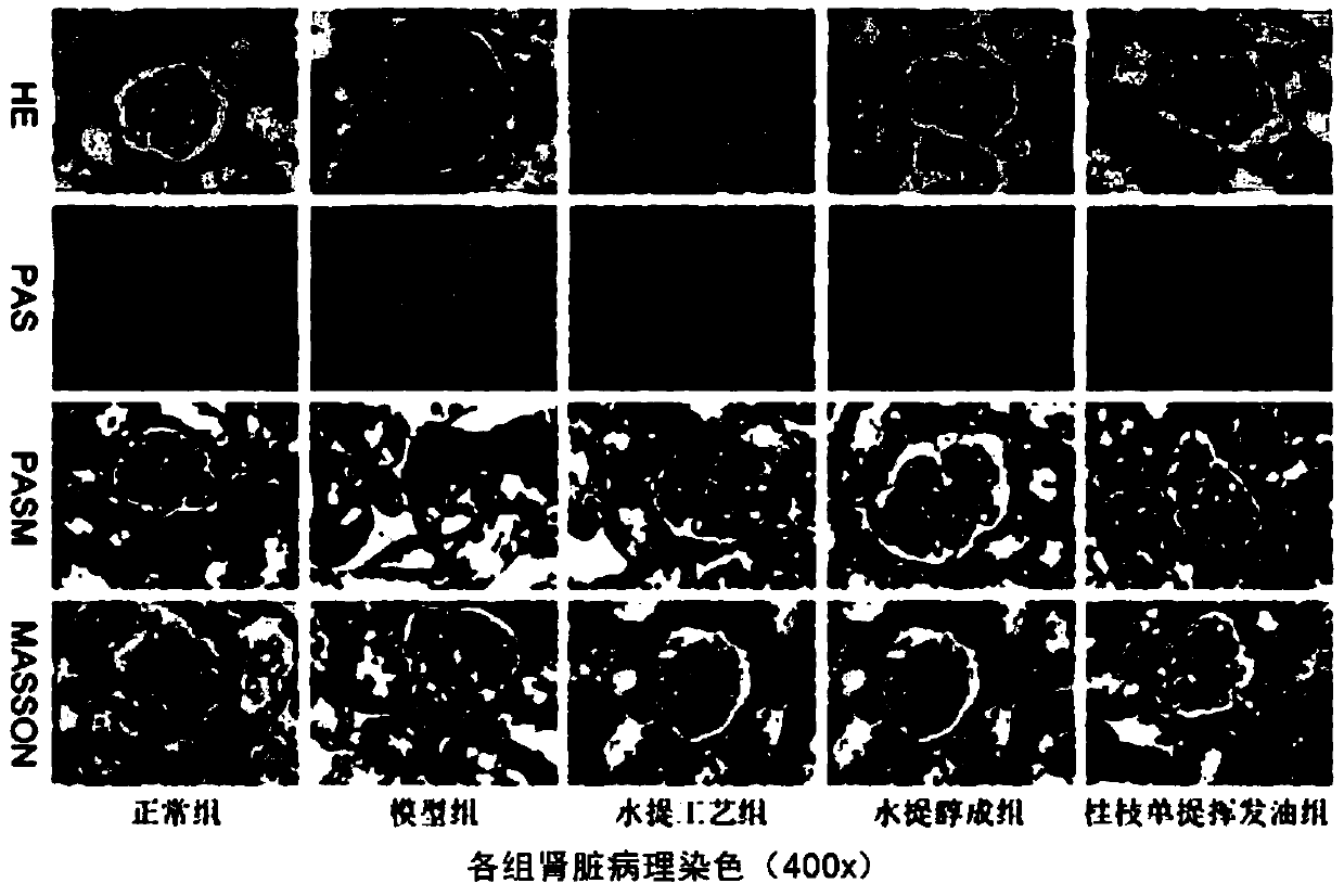 Traditional Chinese medicine particle for treating spleen-kidney insufficiency type IgA kidney disease as well as preparation method and application of traditional Chinese medicine particle