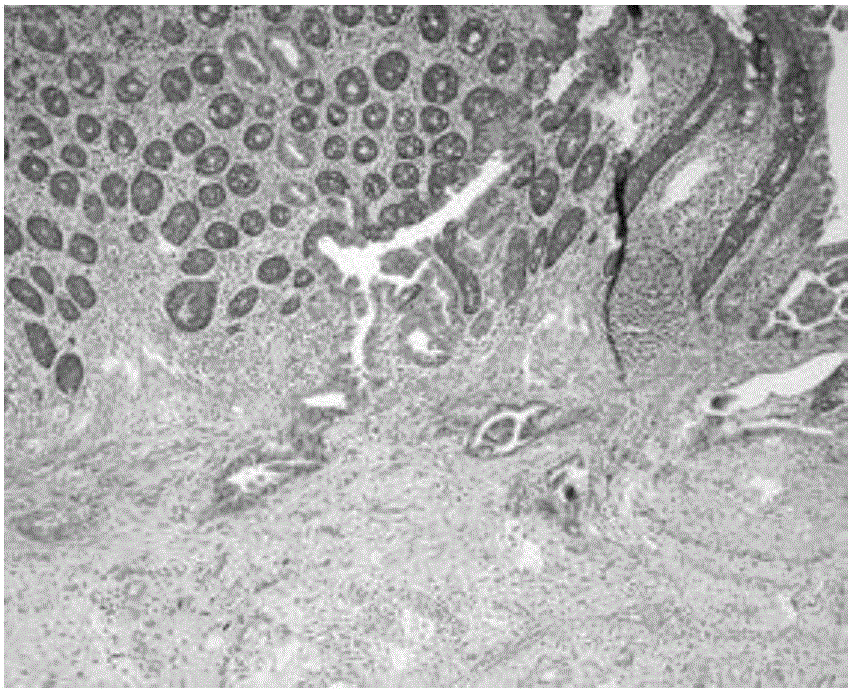 Image processing method and device based on pathological tissue section image organization area