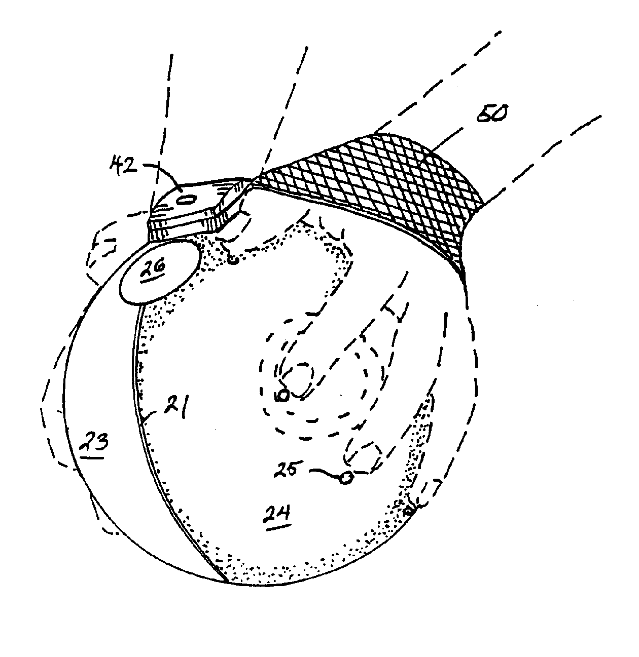 Improved Golf Swing Training Device and Method of Use