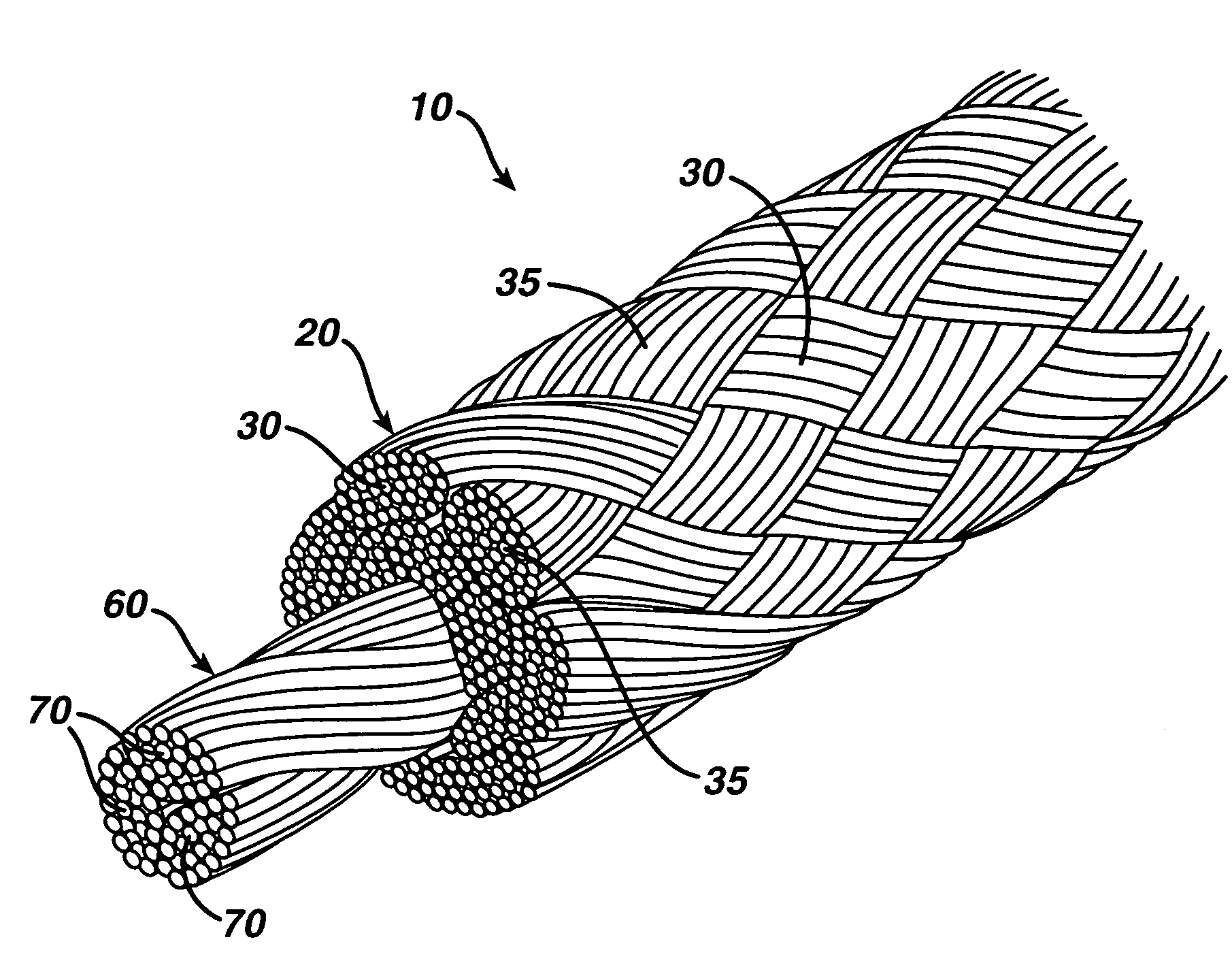 High strength suture with absorbable core