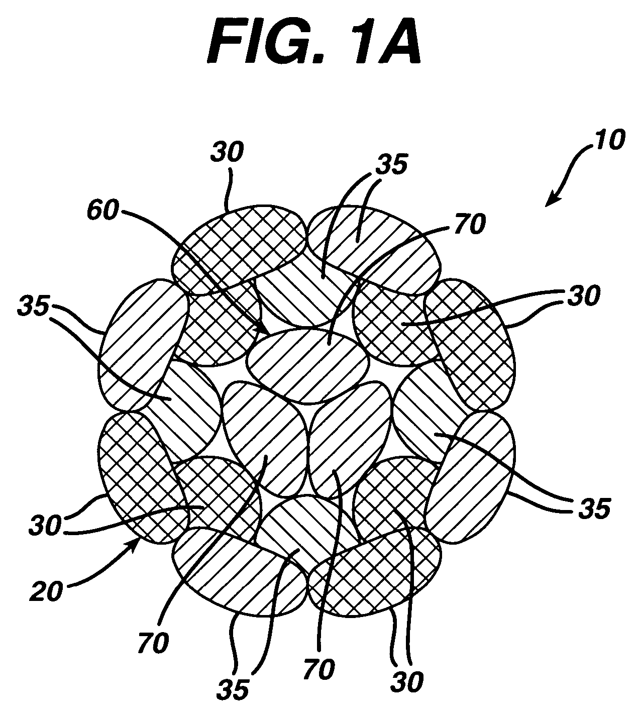 High strength suture with absorbable core