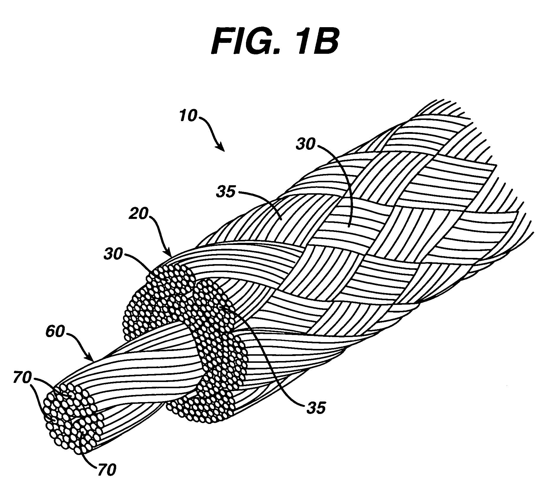 High strength suture with absorbable core