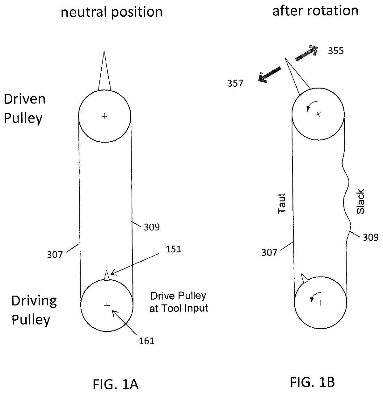 Tension management apparatus for cable-driven transmission