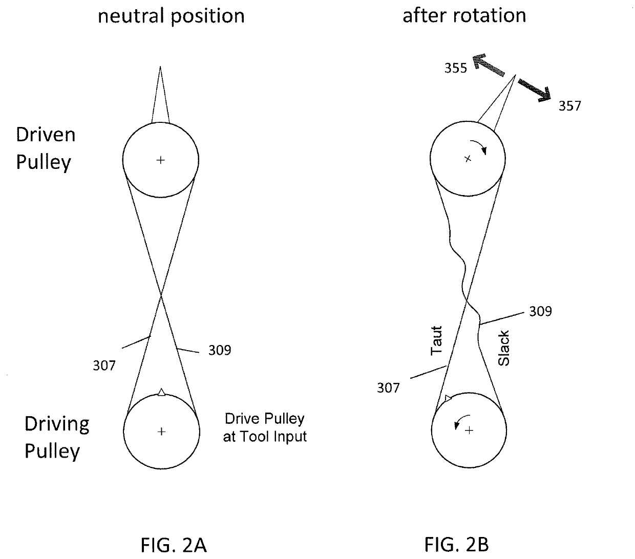 Tension management apparatus for cable-driven transmission