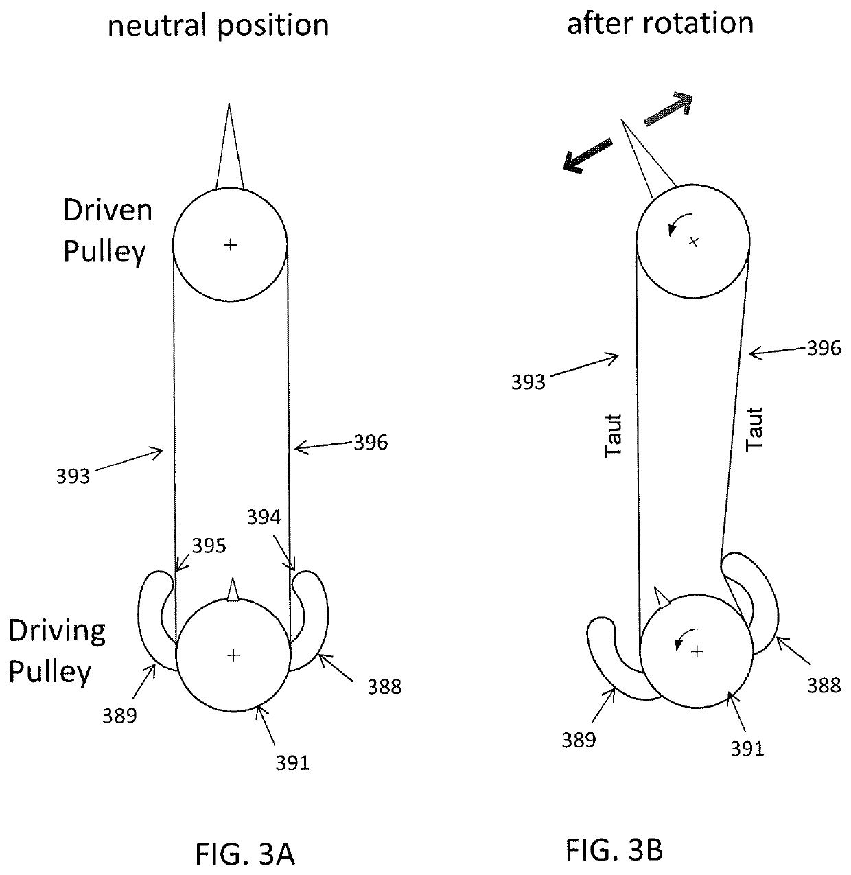 Tension management apparatus for cable-driven transmission