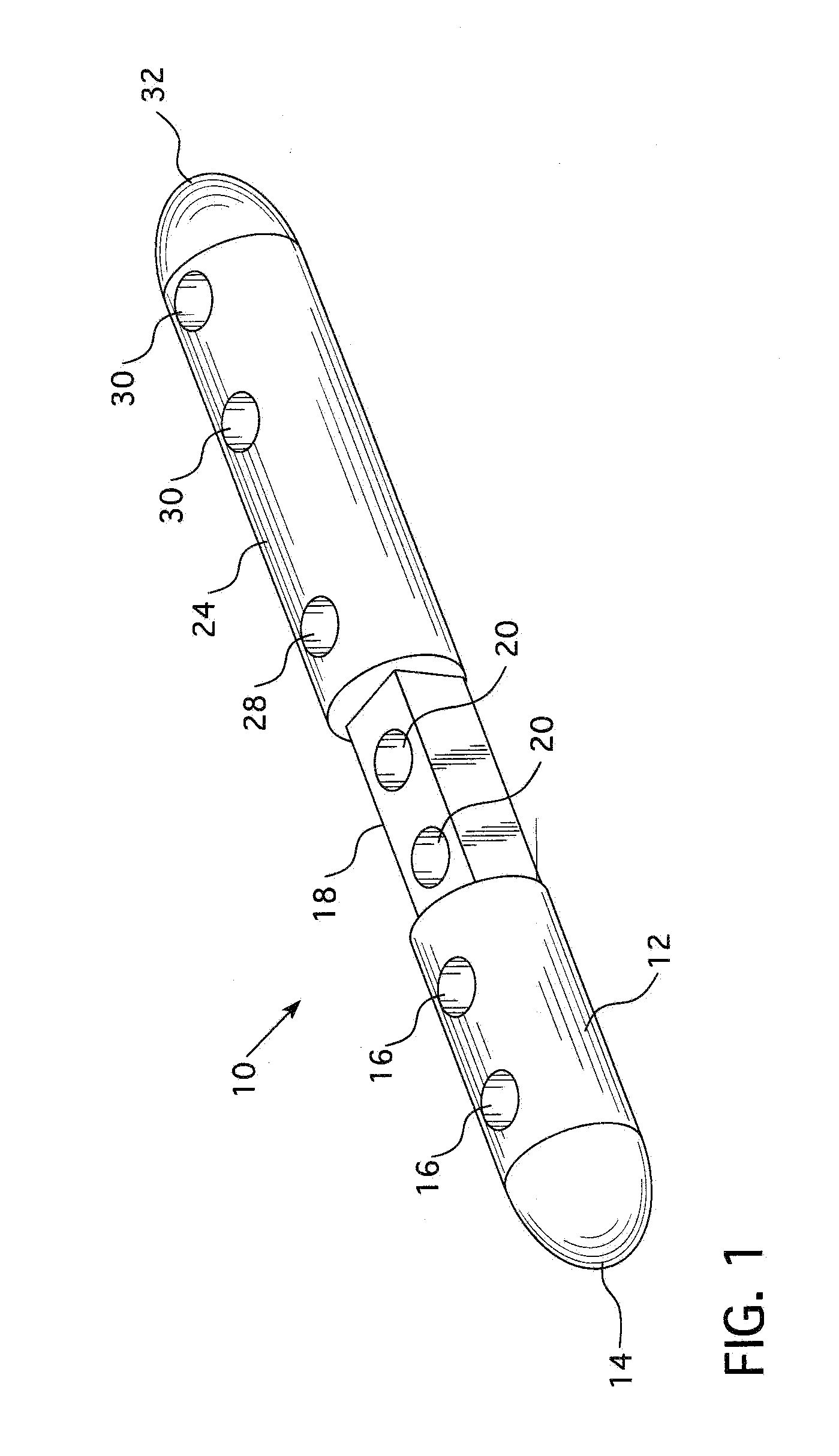 Intramedullary Nail