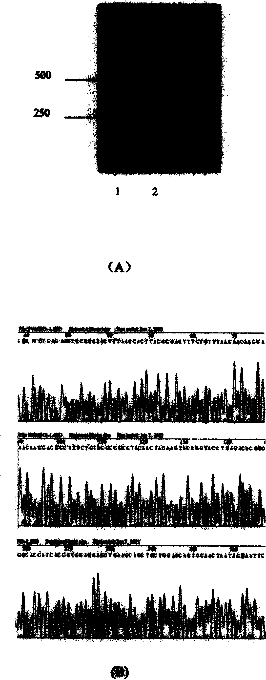 SARS-Cov gene vaccine based on epi-position and its contruction