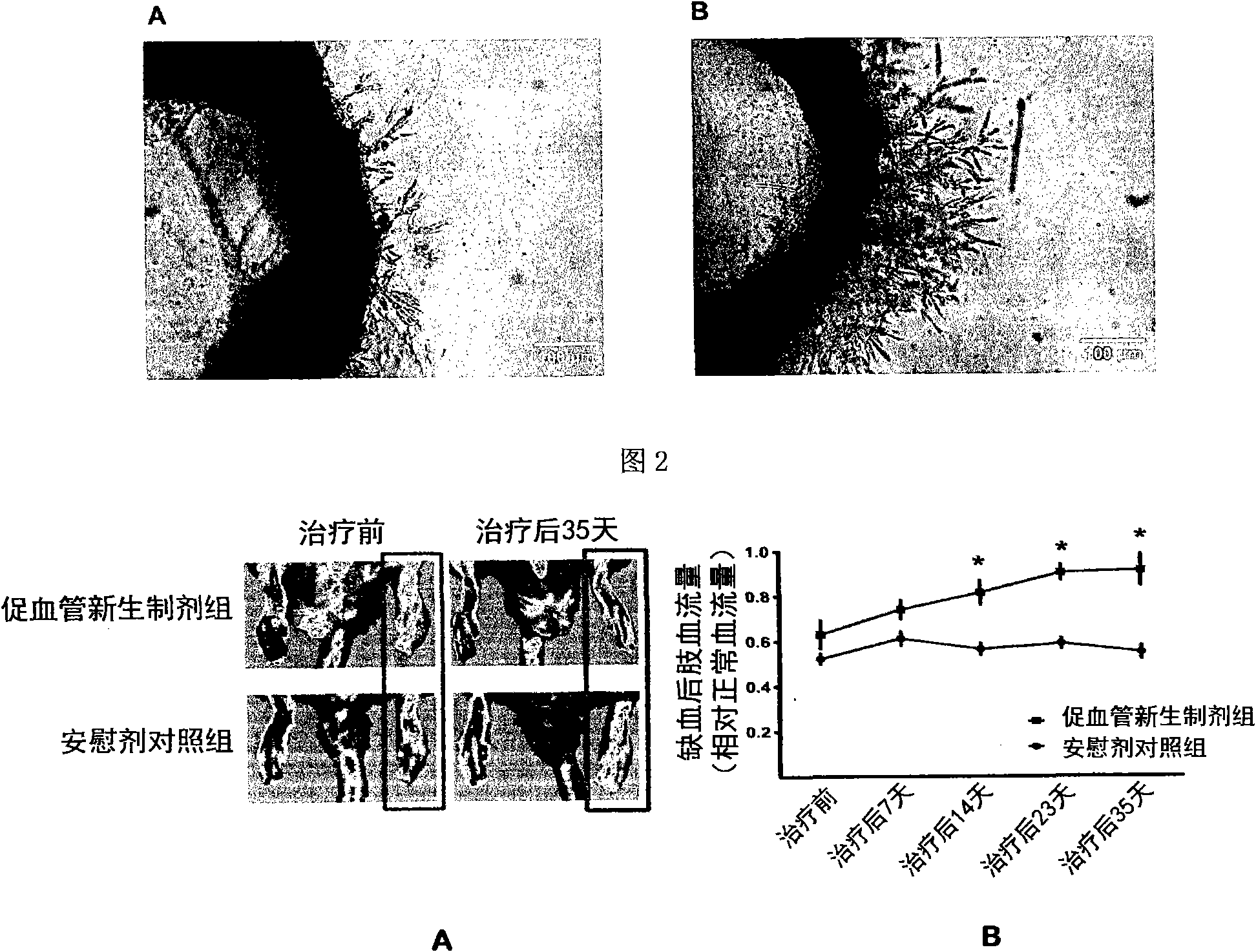 Preparation for promoting revascularization or angiogenesis and preparation method thereof