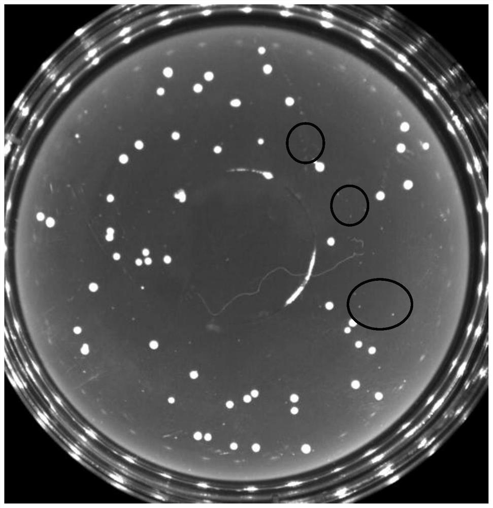 A culture medium and detection method for detecting bifidobacteria