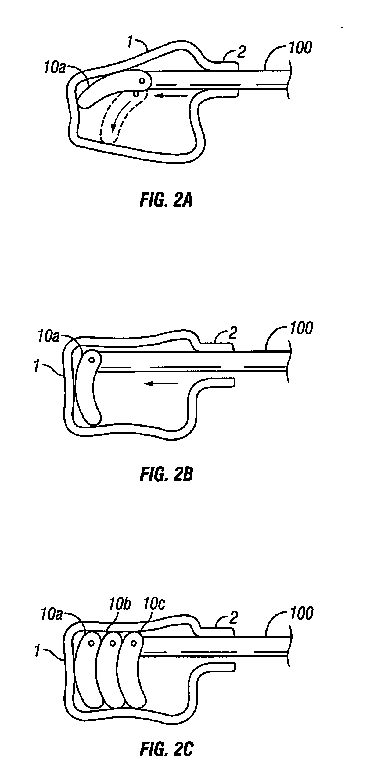 Systems and Methods For Vertebral Body and Disc Height Restoration