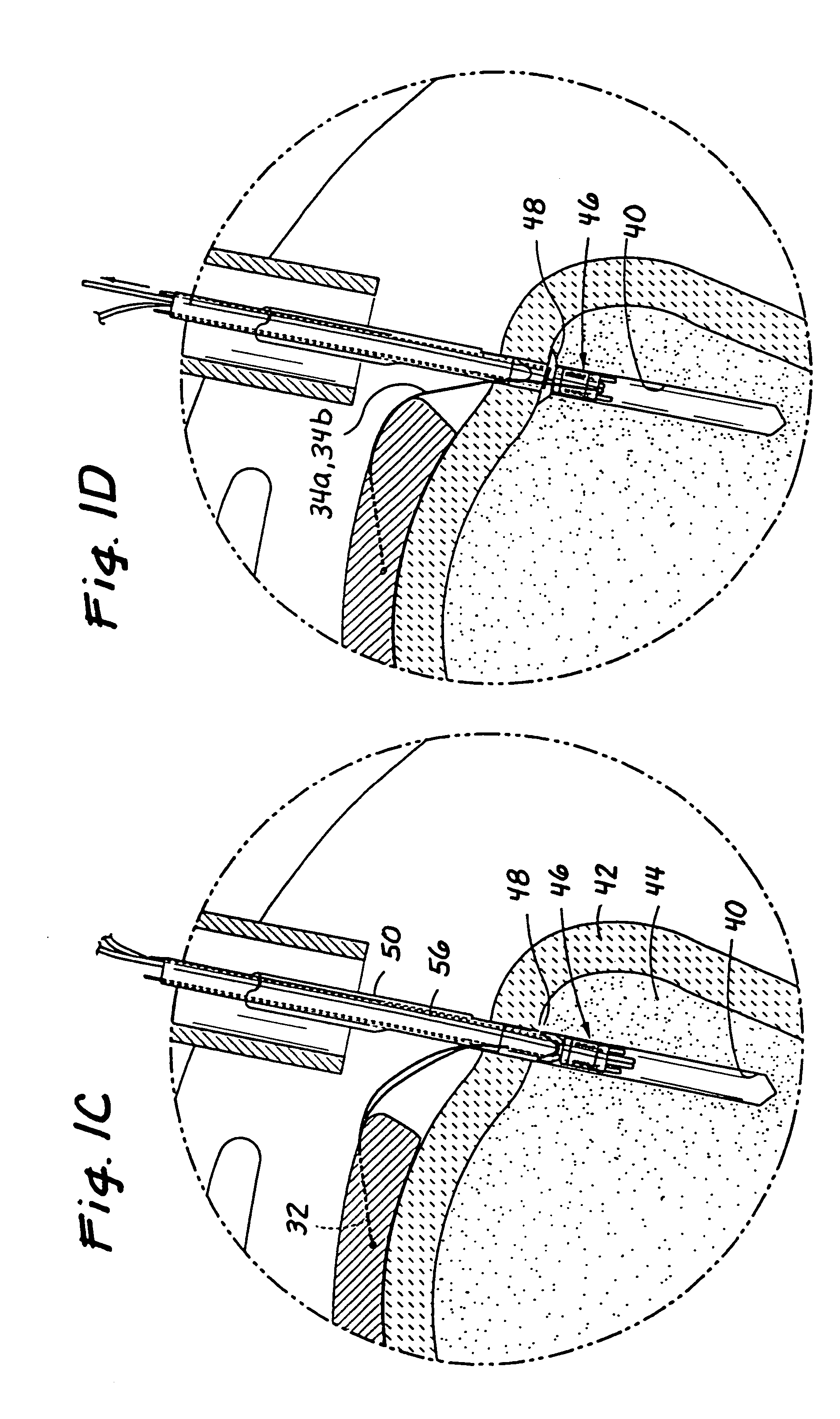 Devices and methods for repairing soft tissue