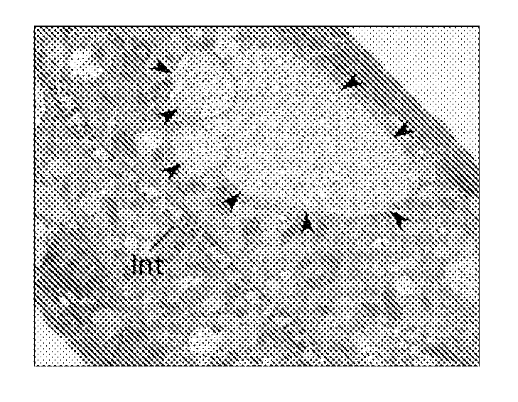 Methods of Treating Disorders Associated with Protein Aggregation