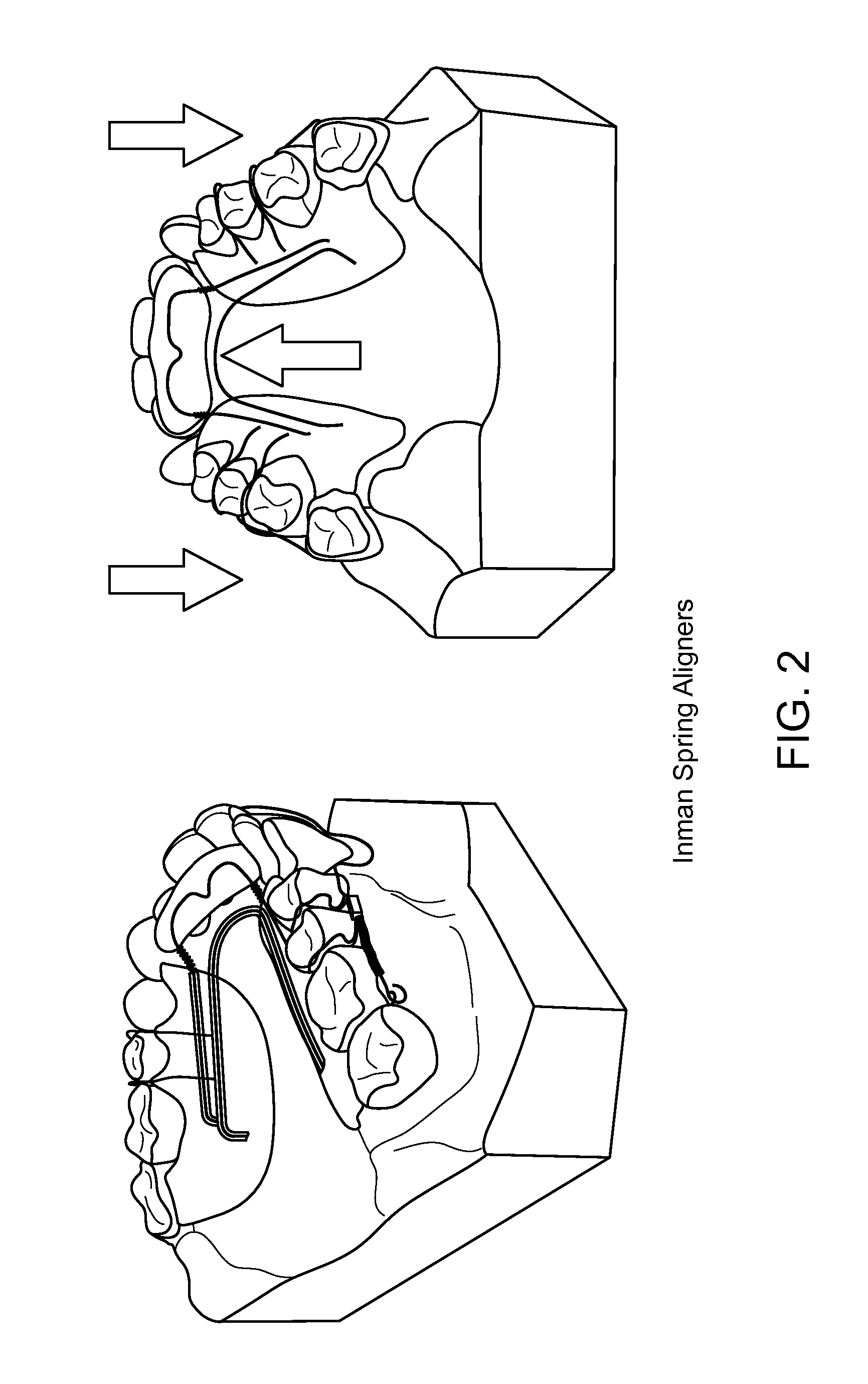 Cyclic interruptive force orthodontic device and system