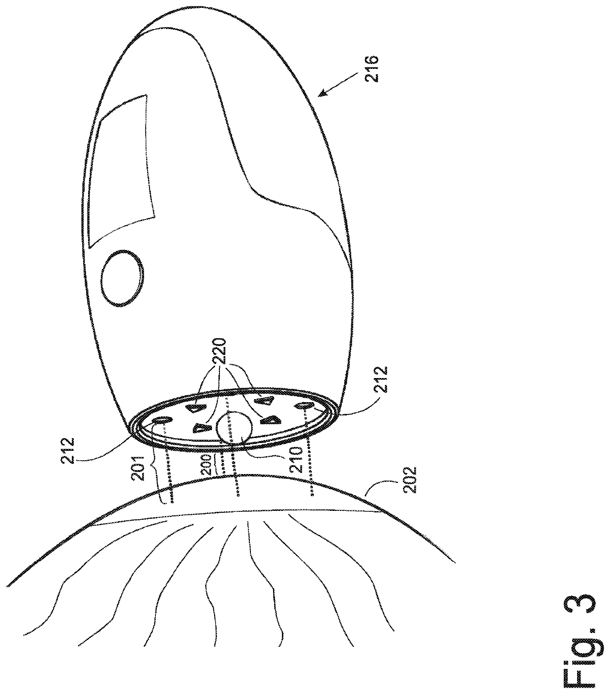 Method and arrangement for eye pressure measurements