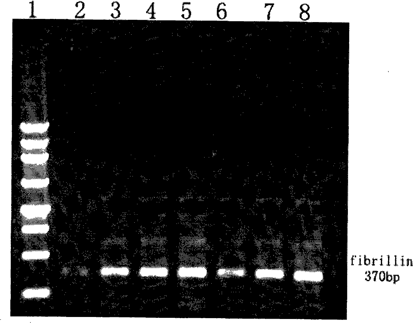 Novel use of Cistanche tubulosa extract