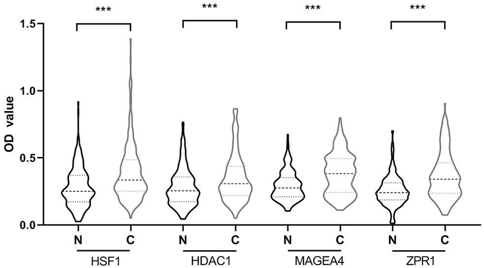 Biomarker for diagnosing esophageal squamous carcinoma and detection kit