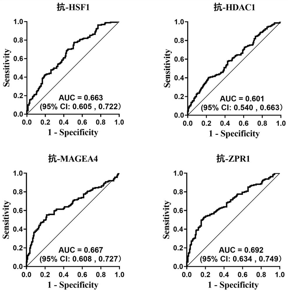 Biomarker for diagnosing esophageal squamous carcinoma and detection kit