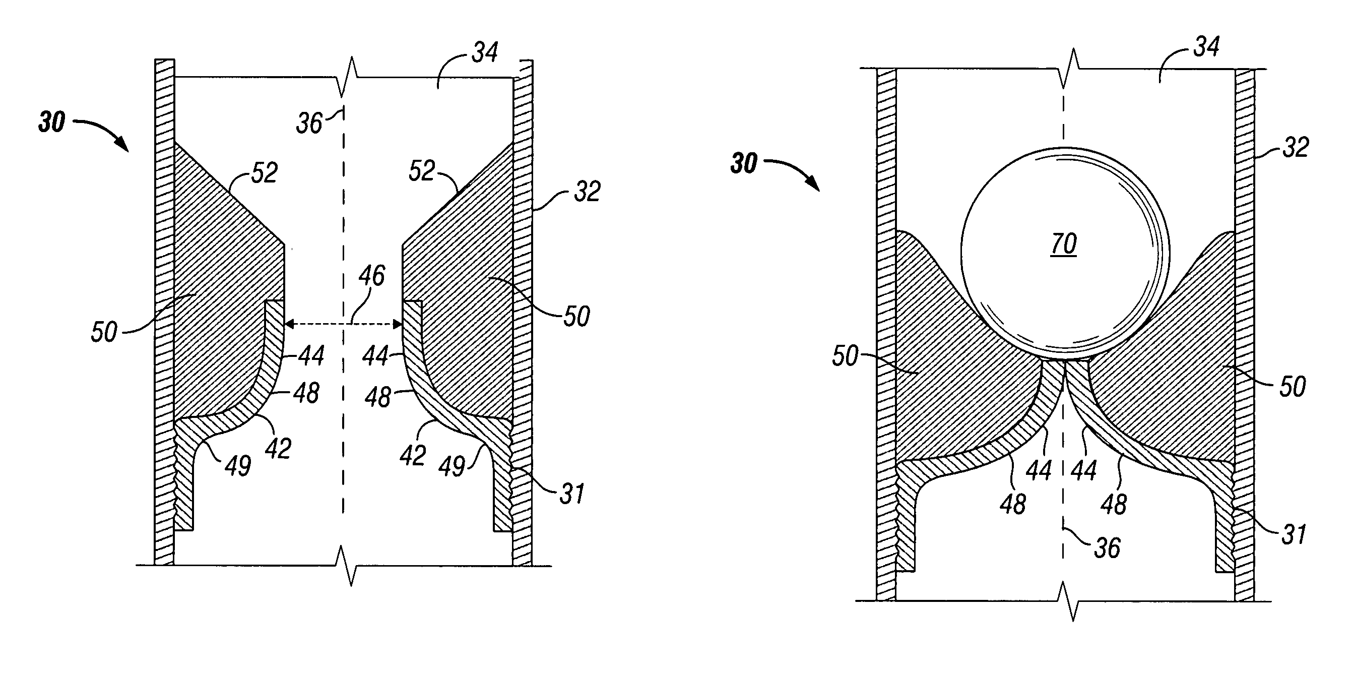 Deformable ball seat