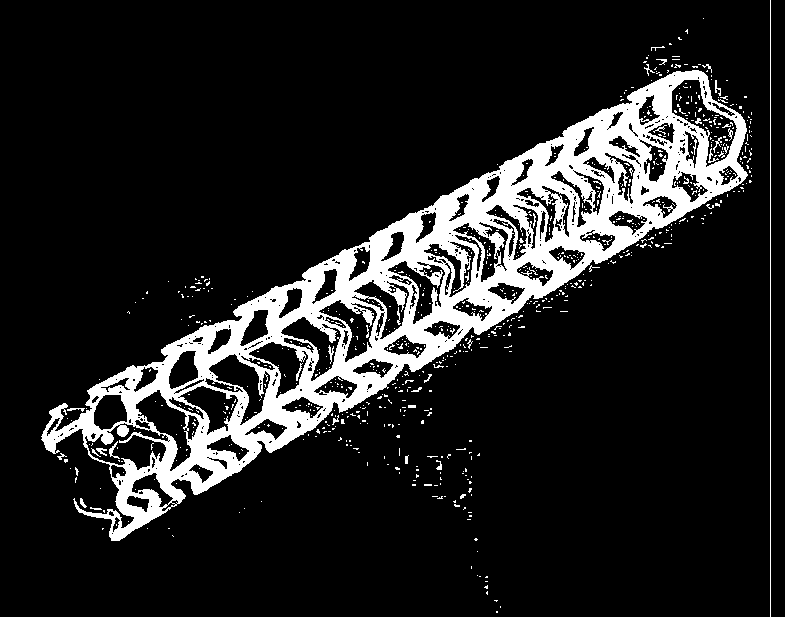 Biodegradable bracket and preparation method thereof