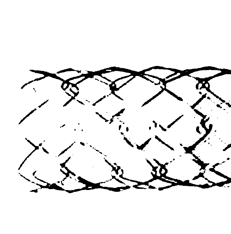 Biodegradable bracket and preparation method thereof