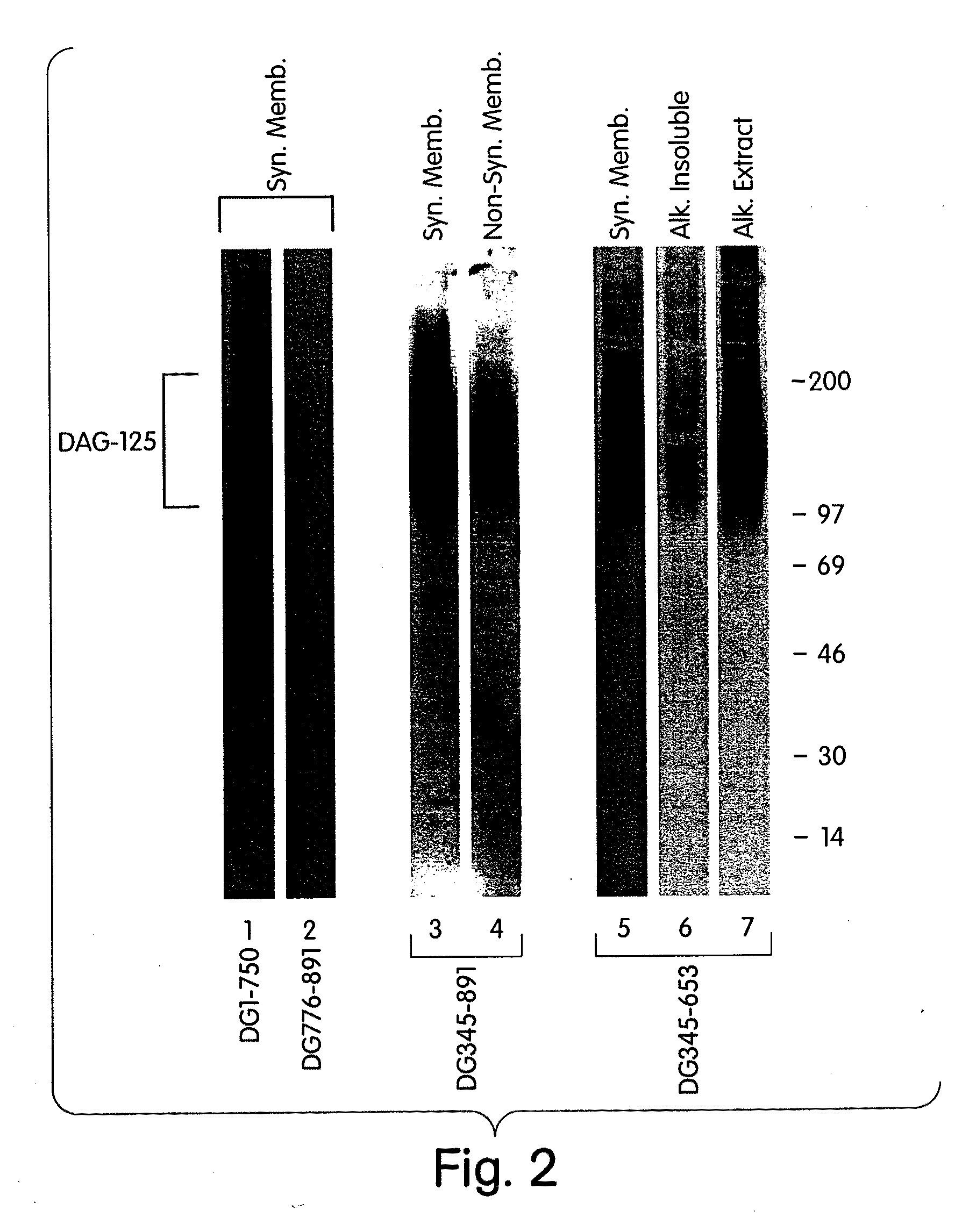 Biglycan and related therapeutics and methods of use