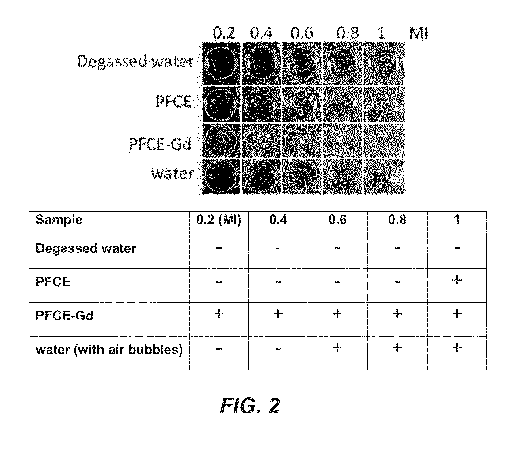 Contrast agent and its use for imaging