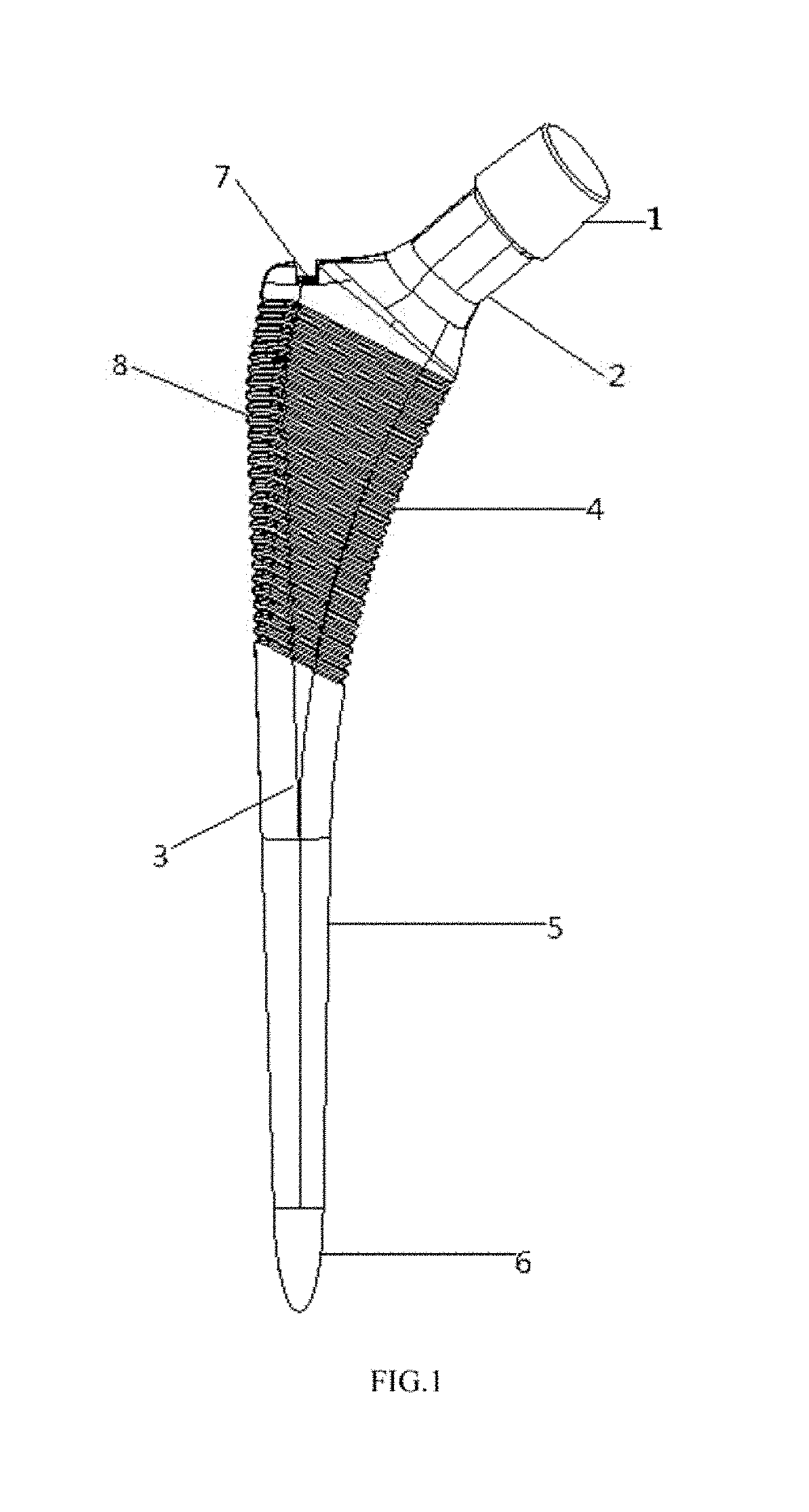 Artificial alpha femoral stem prosthesis