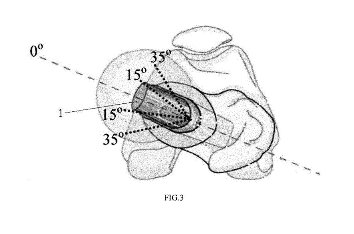 Artificial alpha femoral stem prosthesis