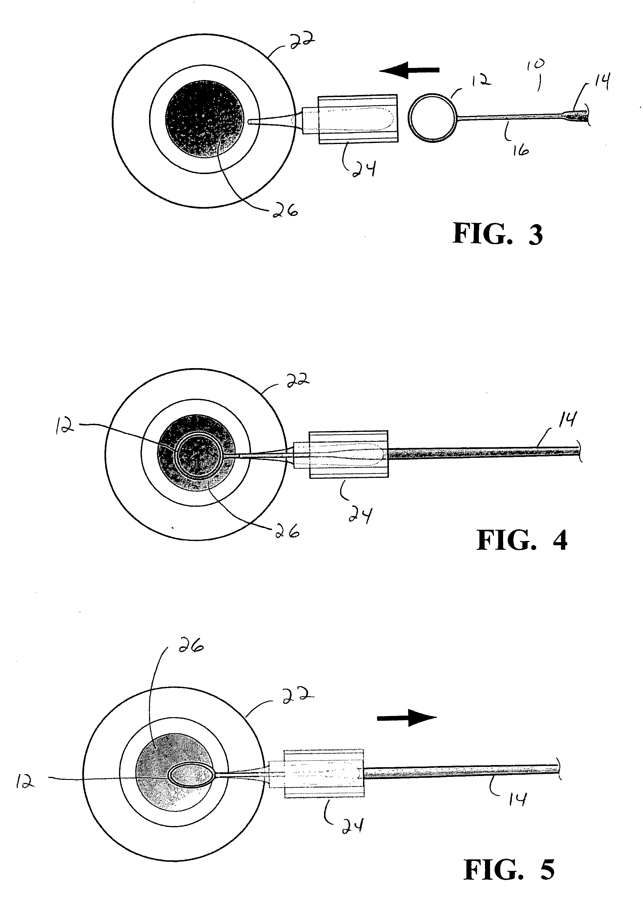 Capsularhexis device