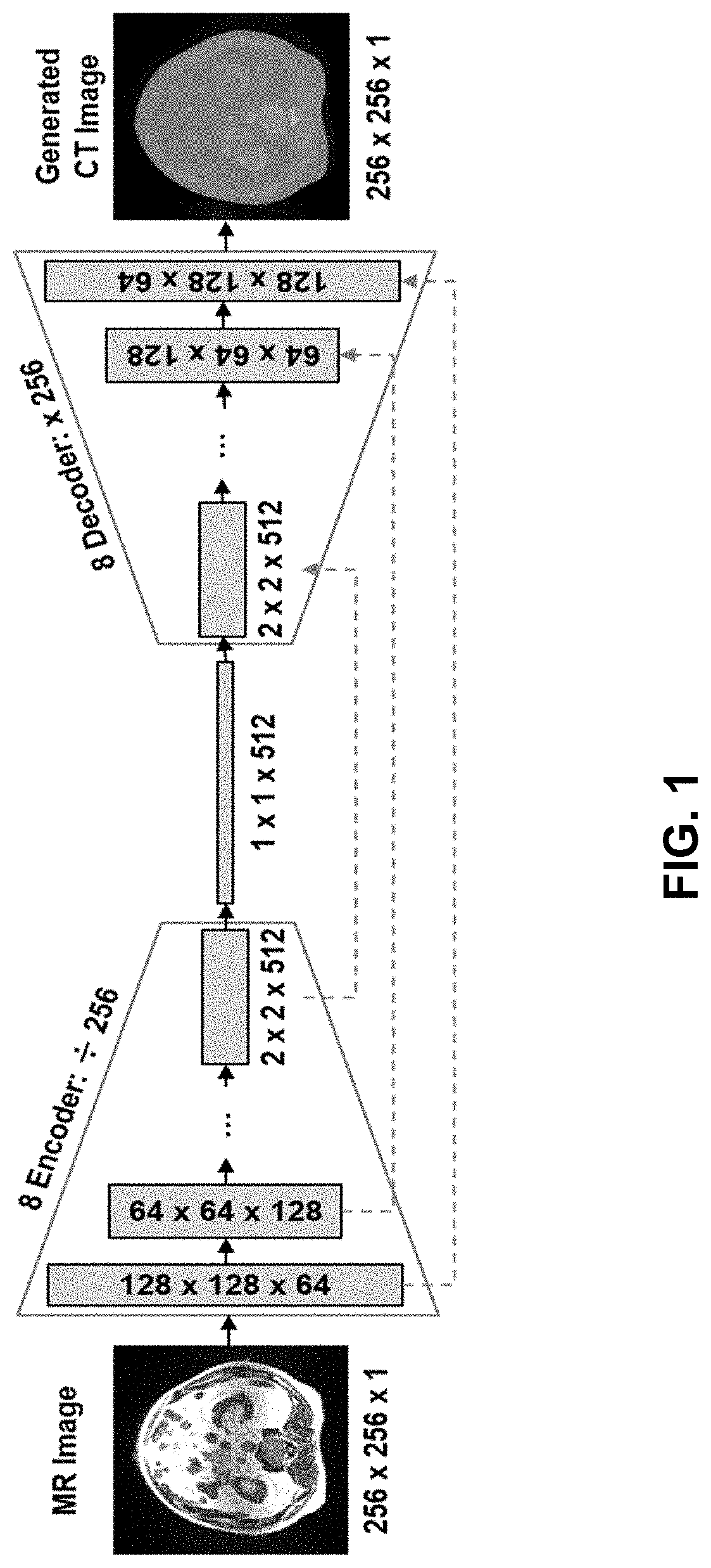 Ml-based methods for pseudo-ct and hr mr image estimation