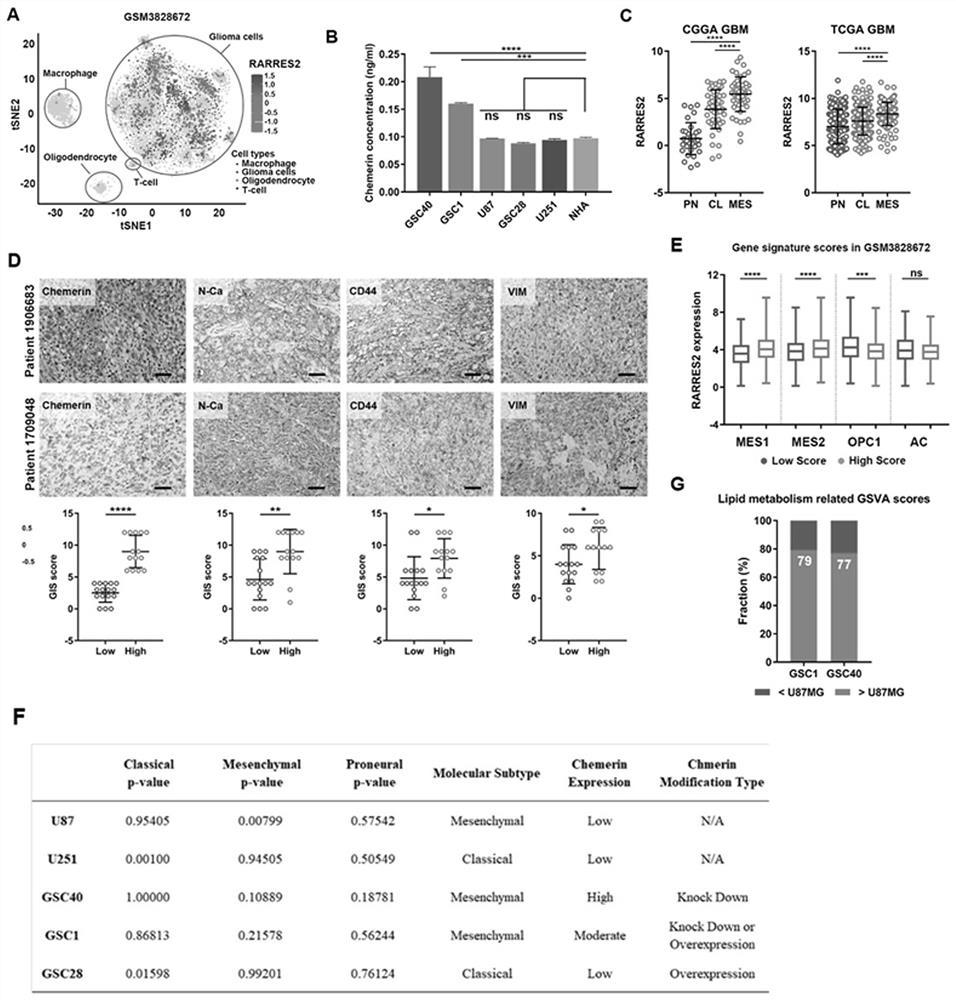 Marker of mesenchymal subtype glioblastoma and application thereof