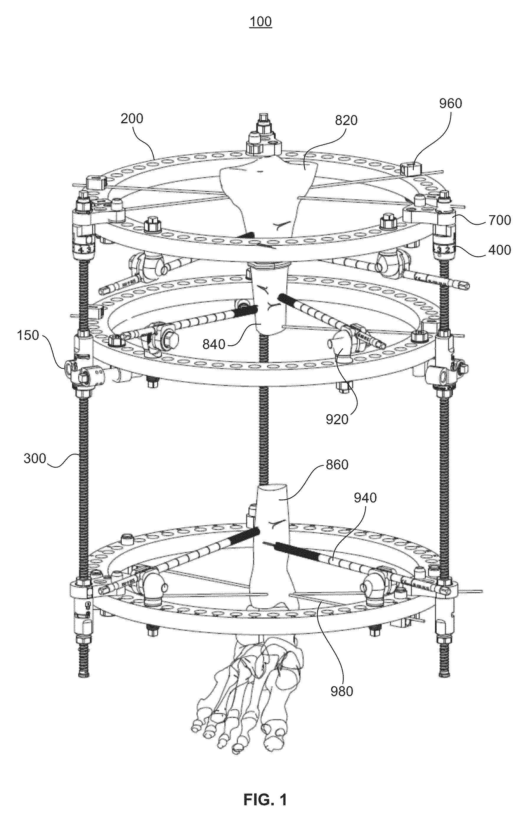 Bone transport external fixation frame