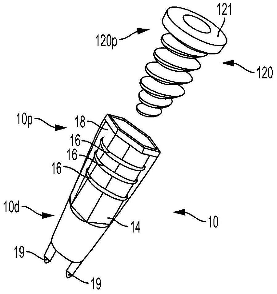 Biceps tenodesis anchor implant