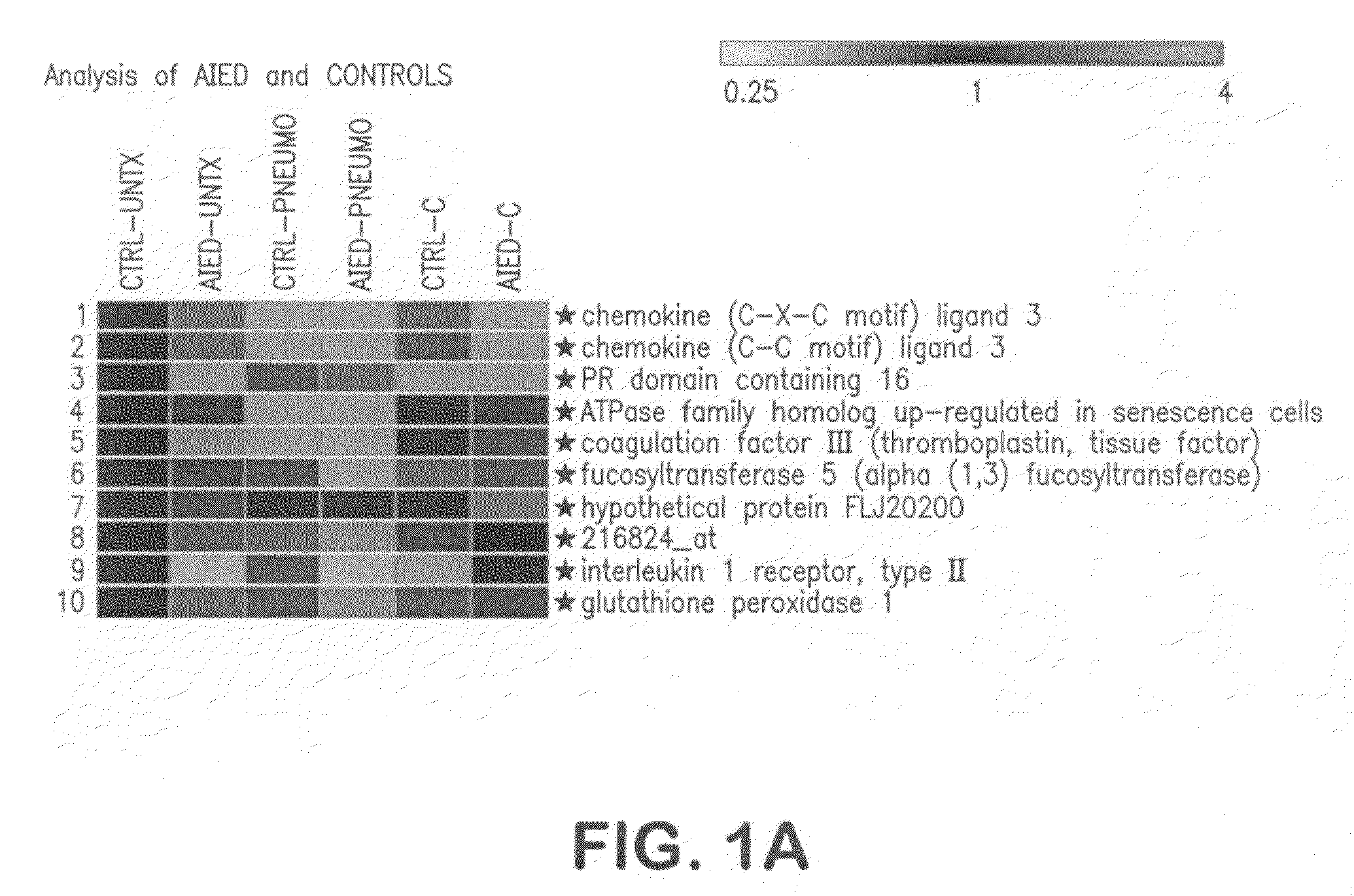 Methods of predicting steroid responsiveness with Il-1RII