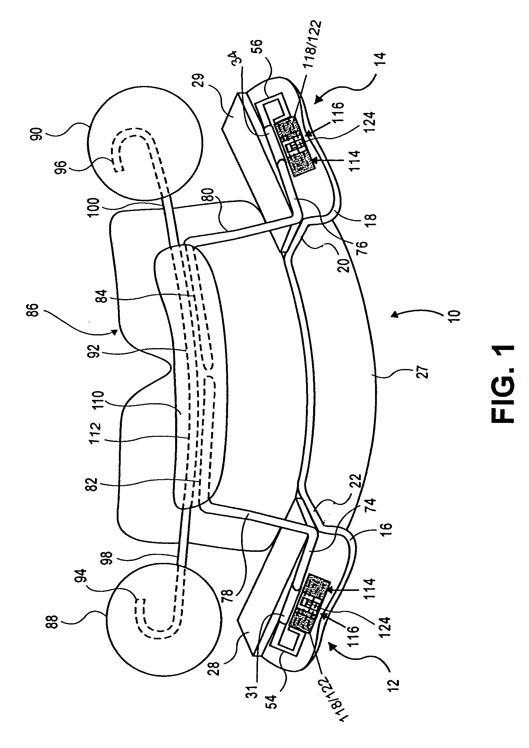 Dental appliance for improving airflow through nasal-pharyngeal airway