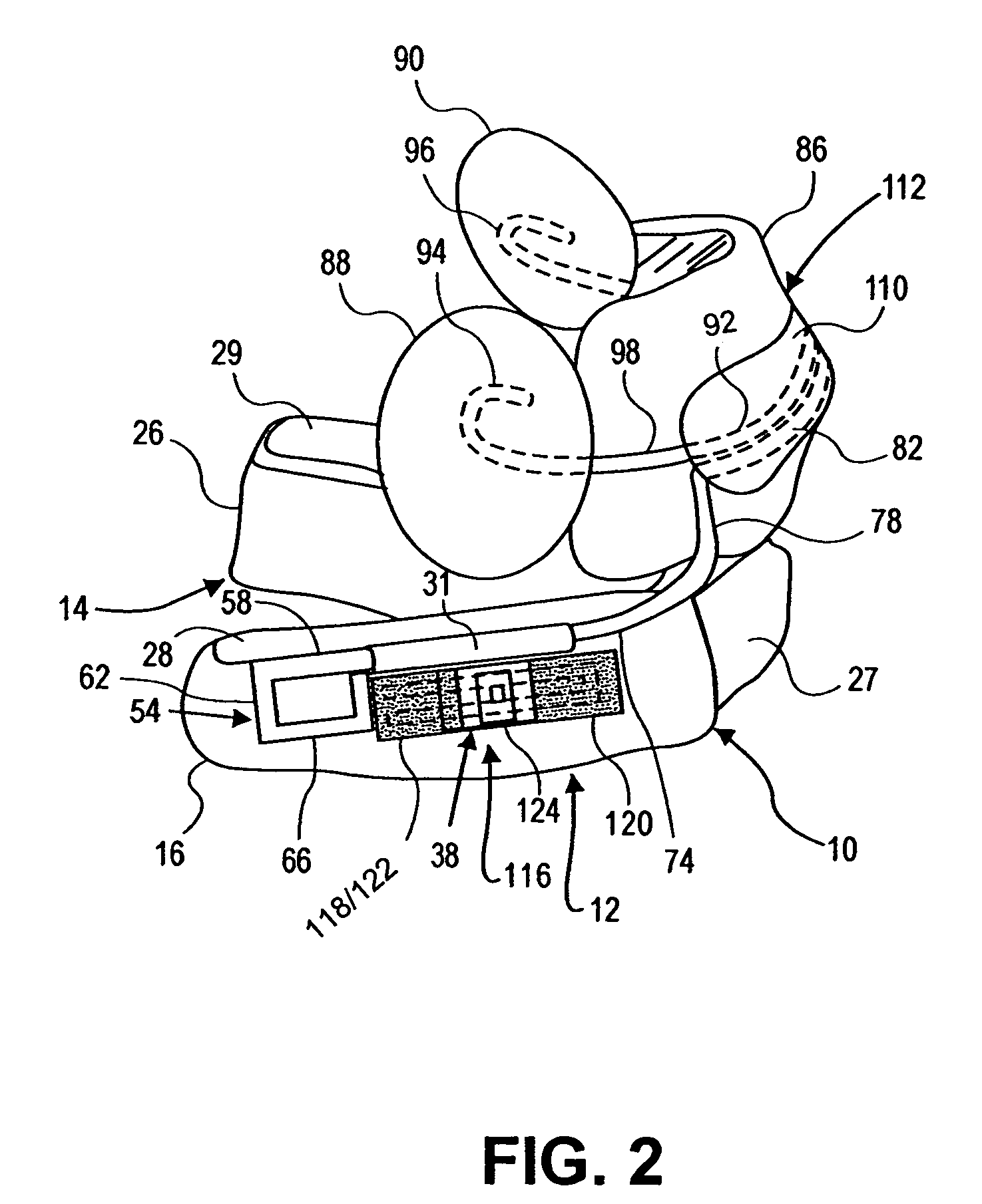 Dental appliance for improving airflow through nasal-pharyngeal airway