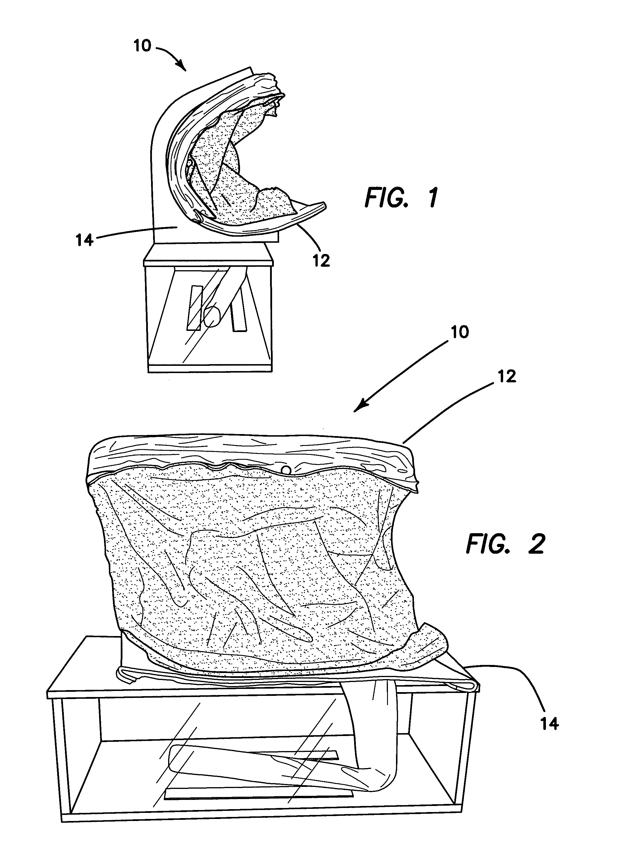 Hernia model